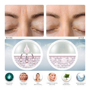 Concentrado Antiedad de Ojos con Células Madre de Manzana y Uva Día y Noche 50X con Infusor para el Cuidado de la Piel