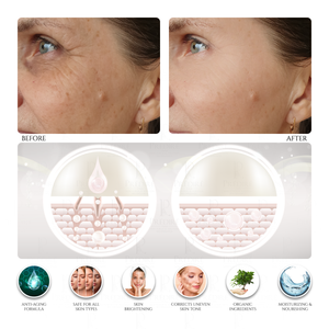 Age-Defying Facial Cooling Mask Powered by Retinol (Removes Impurities & Unclogs Pores), 50ml