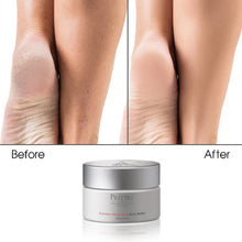 Rutina Completa para Aliviar el Estrés Corporal con Mucina de Caracol, Sal Marina y Retinol | Piel Seca y Áspera, Psoriasis y Callosidades | Jabón, Humectante, Exfoliante Corporal y Manteca Corporal (Edición limitada)