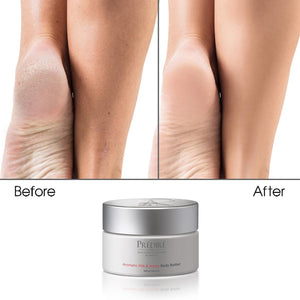 Rutina Completa para Aliviar el Estrés Corporal con Mucina de Caracol, Sal Marina y Retinol | Piel Seca y Áspera, Psoriasis y Callosidades | Jabón, Humectante, Exfoliante Corporal y Manteca Corporal (Edición limitada)