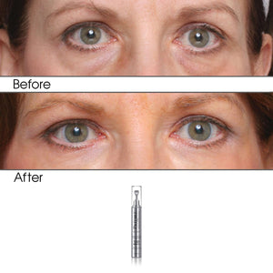 Complete Anti-Aging Eye Care Collection