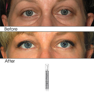 Complete Anti-Aging Eye Care Collection