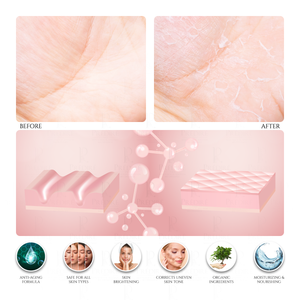 Intensive Foot & Hand Cream for Dry Skin & Rough Skin (Rich with Vitamin E)