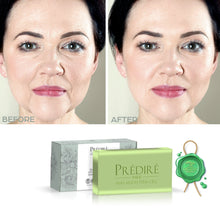 Rutina Completa para Aliviar el Estrés Corporal con Mucina de Caracol, Sal Marina y Retinol | Piel Seca y Áspera, Psoriasis y Callosidades | Jabón, Humectante, Exfoliante Corporal y Manteca Corporal (Edición limitada)