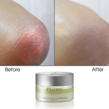 Rutina Completa para Aliviar el Estrés Corporal con Mucina de Caracol, Sal Marina y Retinol | Piel Seca y Áspera, Psoriasis y Callosidades | Jabón, Humectante, Exfoliante Corporal y Manteca Corporal (Edición limitada)